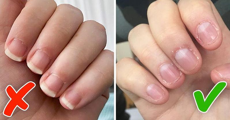 Outra razão pela qual eu sugiro nenhum esmalte é porque o esmalte danifica suas unhas