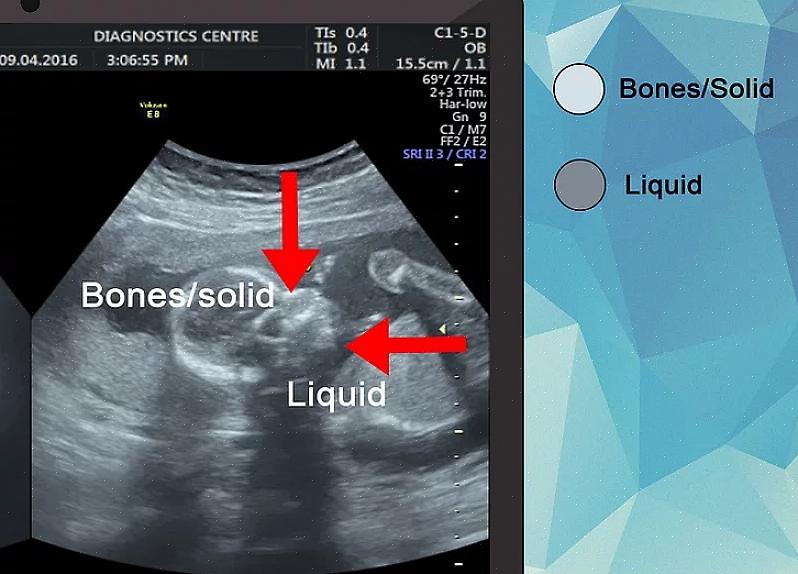 Se você quer aprender como se tornar um ultrassonógrafo