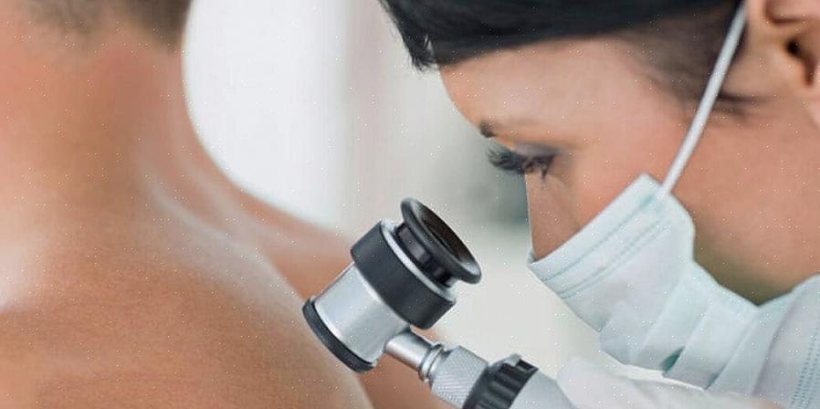 Você fará o DNC ou o exame certificado pela enfermeira dermatológica